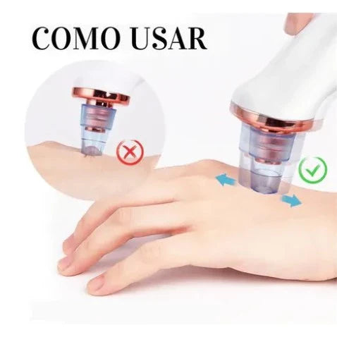 Removedor De Cravos Espinhas